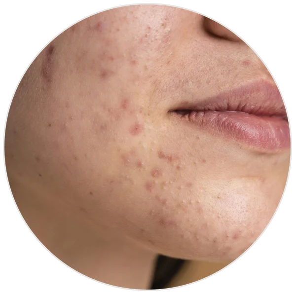 Ashwagandha and Kashmiri saffron face serum for dark spots and dullness