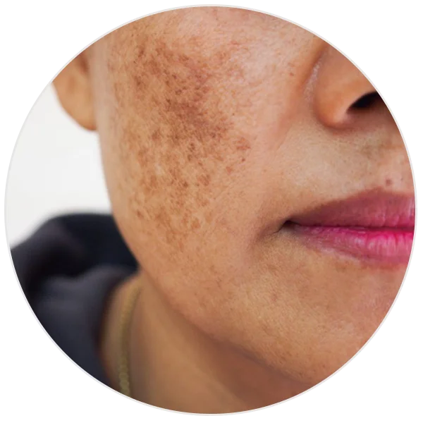 Ashwagandha and Kashmiri saffron serum for pigmentation and uneven skin tone